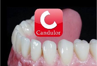 Зубные протезы Candulor
